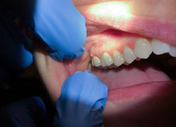 Best Weekend Emergency Dentist in Cockeysville, MD