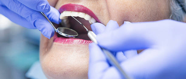Best Emergency Dental Care for Broken or Chipped Teeth in Cockeysville, MD